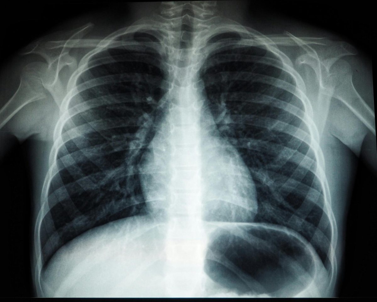 Abstract X-Ray